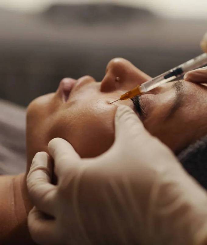 Does under eye fillers relate to orbital fat compartments