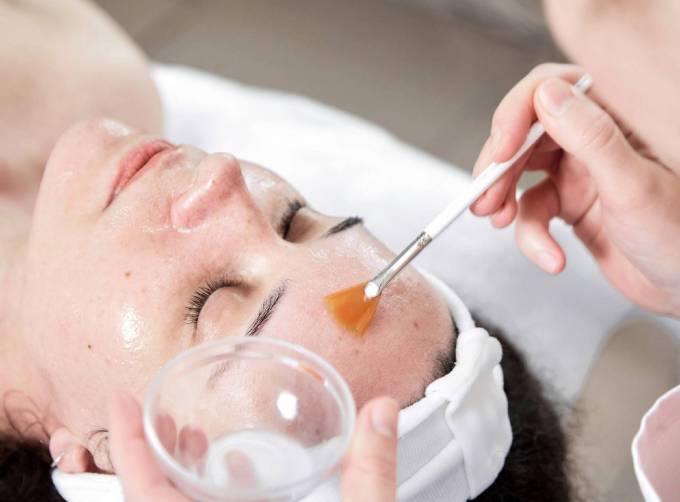 Who Needs a Chemical Peel Today?