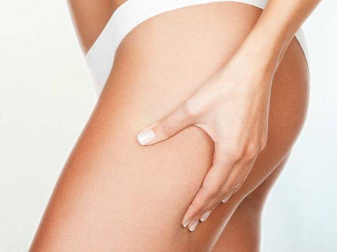 Is cellulite treatment price based on area size?
