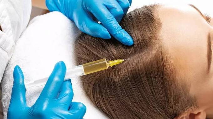 Best PRP Hair Treatment: Does It Really Work?