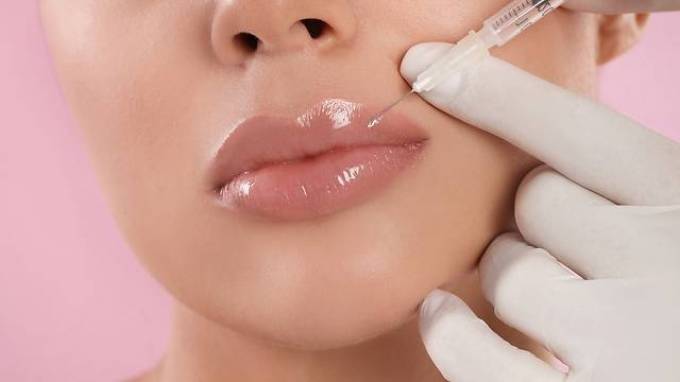 Best Lip Fillers Guide: Safe Choices for Natural Results