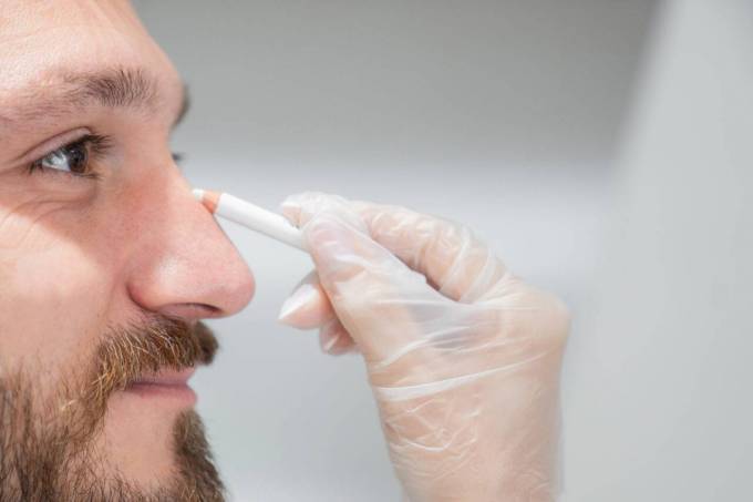 Is Rhinoplasty treatment suitable for adolescents?