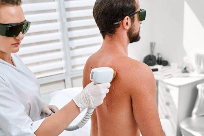 Why Hair Removal Cost is Different Today?