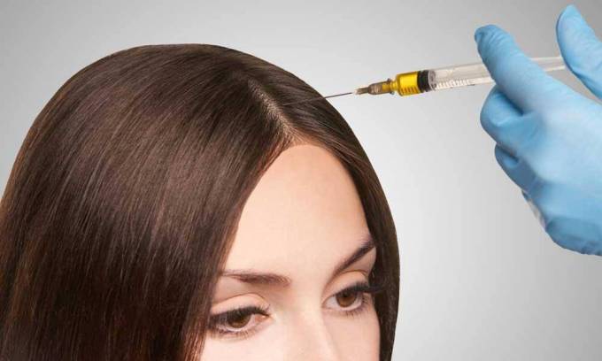 Best PRP Hair Treatment: Key Benefits
