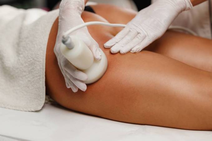 What Is Cellulite Treatment Targeting Structurally?