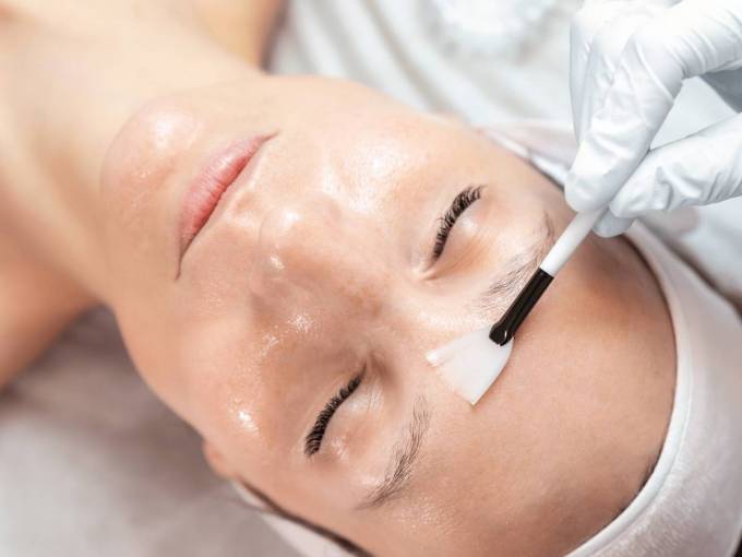 What Chemical Peel Means in Dermatology Skin Care Context?