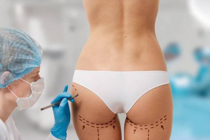 How Butt Fillers Enhance Shape and Confidence