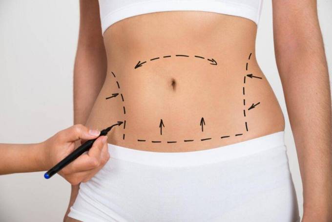 Does Location Influence Tummy Tuck Cost Treatment?