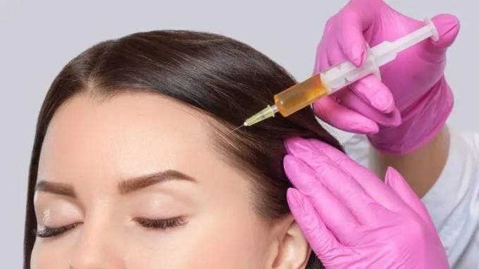 What Happens During Hair Plasma Treatment?