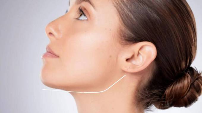 Does jawline contouring price include consultation costs?