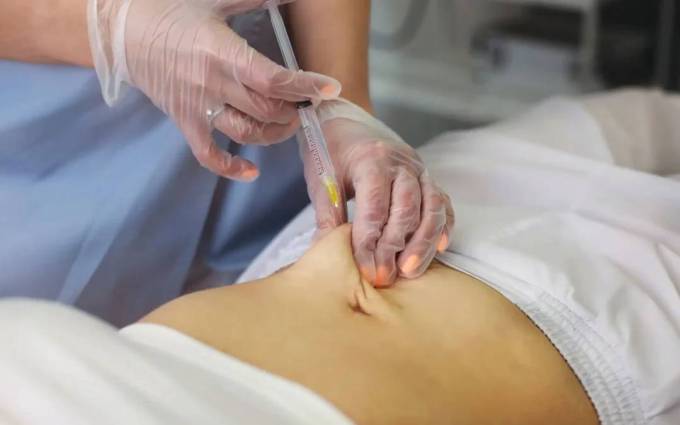 Does Aqualyx Injection Treatment Tighten Skin?