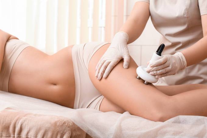 What Makes Cellulite Treatment Cost Vary from Person to Person?