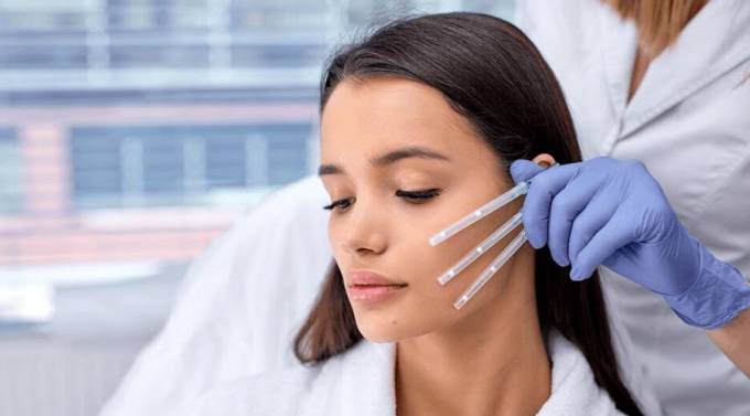 Why Thread Lift Procedures Are Growing in Popularity