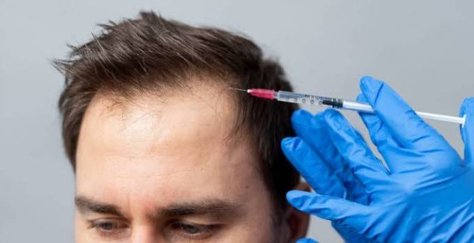 Does GFC Treatment For Hair Support Scalp Health?